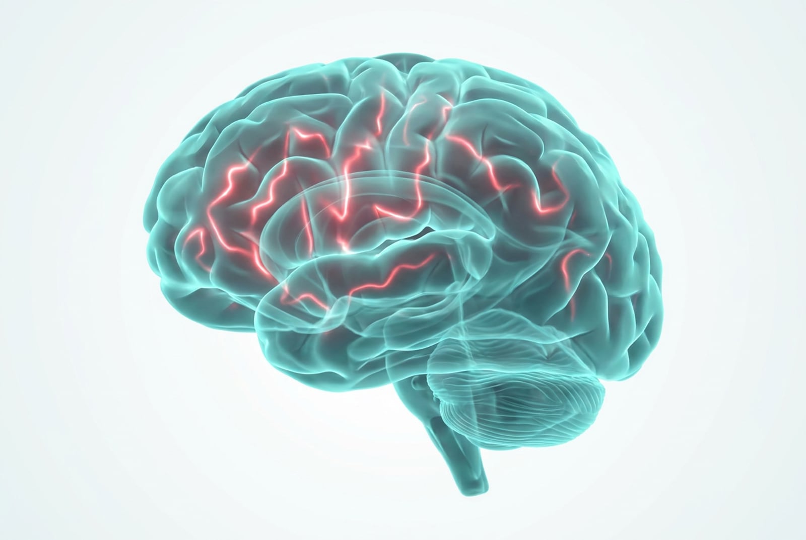 EMT para el dolor crónico: cerebro traslúcido donde las vías de dolor enrojecidas se atenúan hacia tonos de calma